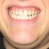 yellow teeth!!!!